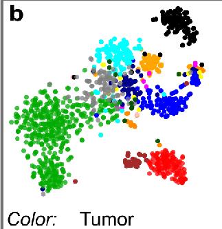 SCENIC Mapping regulatory cell states of melanoma with SCENIC tsne on expression data tsne on