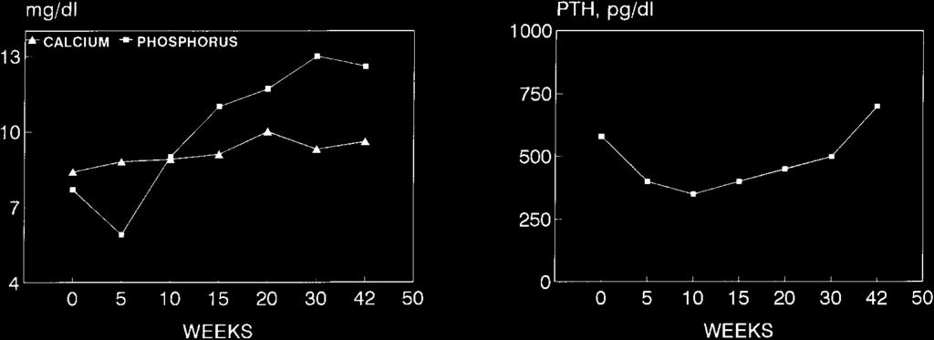 60 F. Llach and M. Yudd Fig. 1. The effect of severe hyperphosphaetamia (left) on PTH (on the right) in a patient with significant hyperparathyroidism receiving calcitriol, 2 mg i.v., three times a week at the end of each dialysis.