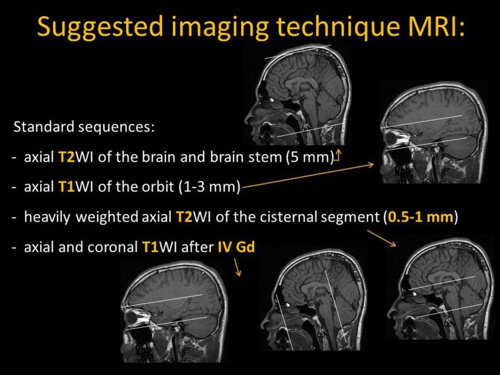 Fig. 8: MRI technique References: M. Lemmerling; Beervelde, BELGIUM B) Structured report: Stucture to be inspected Most frequent anomaly in this location 1.