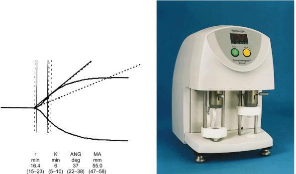 Figure 1.4.3 TEG Analyser and a Computer Generated TEG Trace Thrombelastograph(R) 5000 coagulation analyser (courtesy Medicell Ltd.) (Figure 1.4.3) and a normal trace generated by computerized software (courtesy of Dr Sue Mallet, Royal Free Hospital).