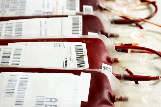 Risks of RBC transfusion Transfusion associated circulatory overload (TACO) Transfusion reactions Bacterial