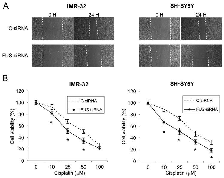 2950 WANG et al: mir-141/fus regulate proliferation and migration in neuroblastoma Figure 7. FUS downregulation inhibits migration and increases cisplatin sensitivity in neuroblastoma cell lines.