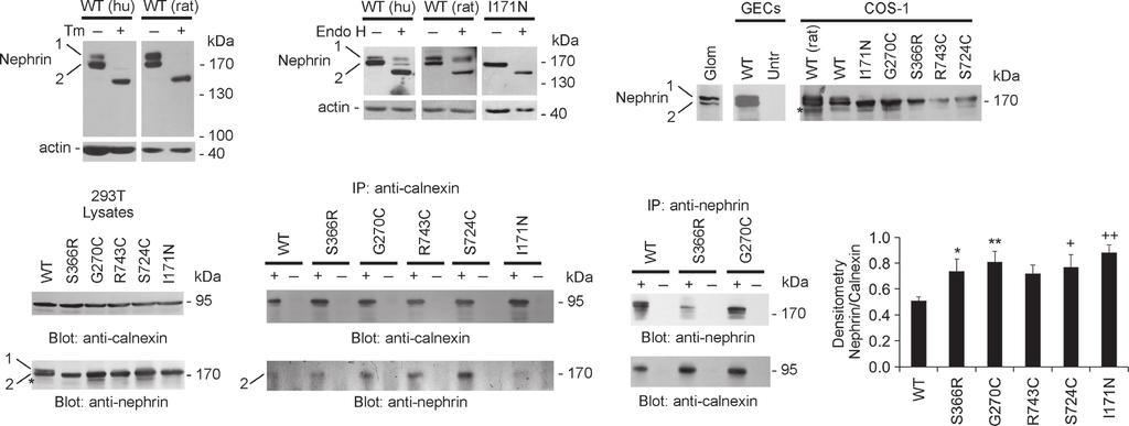 T. Drozdova et al. Nephrin Missense Mutations and Chaperone Interactions A B C D E F G Figure 1.
