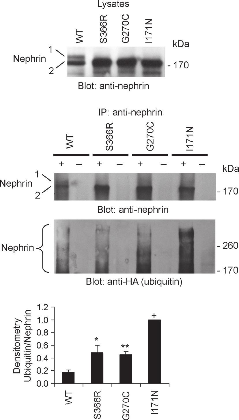 Representative immunoblots (A and C) and densitometric quantification (B and D) are presented. The degradation of nephrin was reduced by MG132. B: *P < 0.025 (MG132 vs. untreated at 6 h), **P < 0.