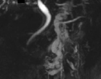 shows small intestinal (arrow) and retrocrural (arrowhead) lymphatic trunks.