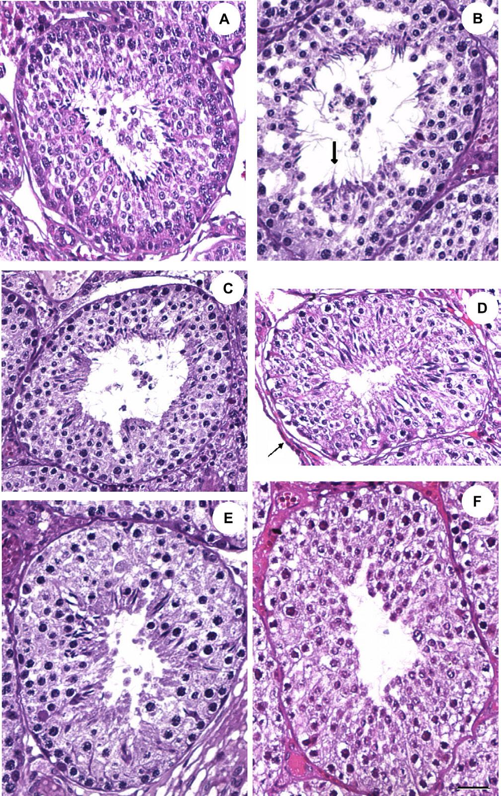 1409 Figure 1. Standardization of Johnsen-like scores in the seminiferous tubule cross-sections of control group rabbits stained with hematoxylin-eosin (HE). A. Johnsen-like score 10. B.