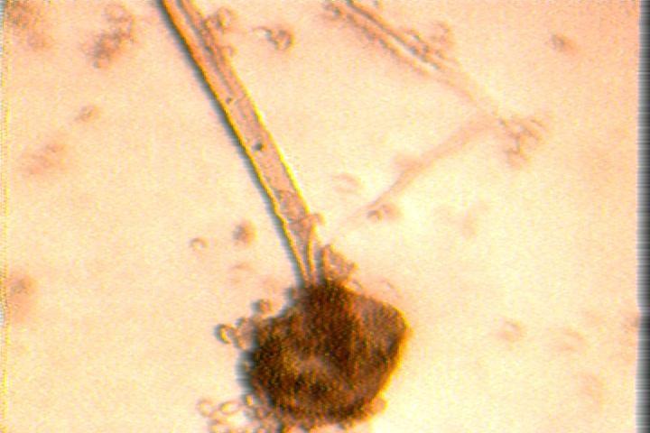 Figure 5: Sporehead and mycelia of Aspergillus niger isolated from Okpa (Microscopic