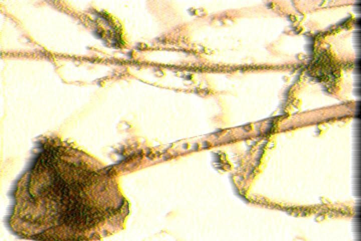 Macroscopic characteristic: Pin like black growth). Figure 6: Sporehead and mycelia of Mucor spp.