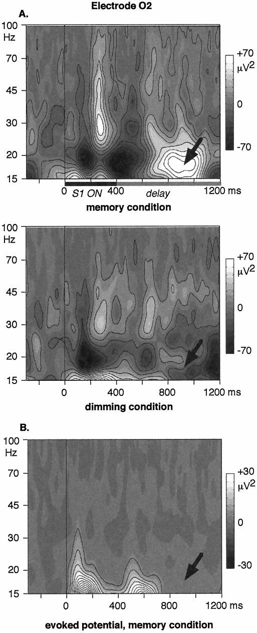Tallon-Baudry et al. Induced Activity and Visual Short-Term Memory J. Neurosci., June 1, 1998, 18(11):4244 4254 4251 Figure 6.