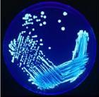 Vibrio fischeri (Slika 8). V skupini Vibrio je prav tako zelo znan predstavnik, in sicer Vibrio cholerae, ki povzroča hudo človeško bolezen kolero (Madigan in Martinko, 2006).