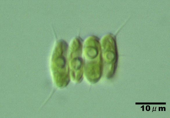 Slika 9: Desmodesmus subspicatus pod mikroskopom (Vir: http://www.shigen.nig.ac.jp/algae/straindetailaction.do?strainid=3162