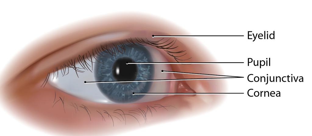 What is a living donor kerato-limbal stem cell transplant? This surgery is done to treat limbal stem cell deficiency.