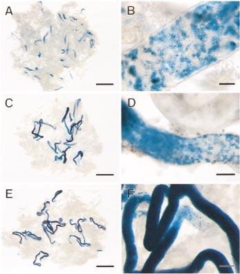 1432 NAGANO ET AL. FIG. 3. Colonization of recipient mouse seminiferous tubules by donor cells from the first to third month after transplantation.
