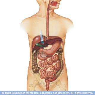 Status Presence Gastrointestinal system: Abdomen is distenced due to ascites, painless. No visible peristalsis.