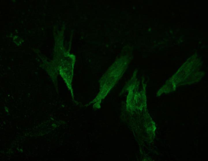 staining of α-tubulin