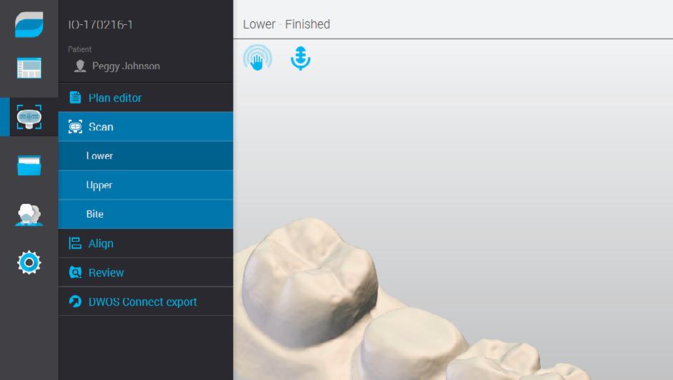 INTUITIVE SCANNER INTERFACE Simplicity, ease of use and flexibility are the hallmarks of Dental Wings software.