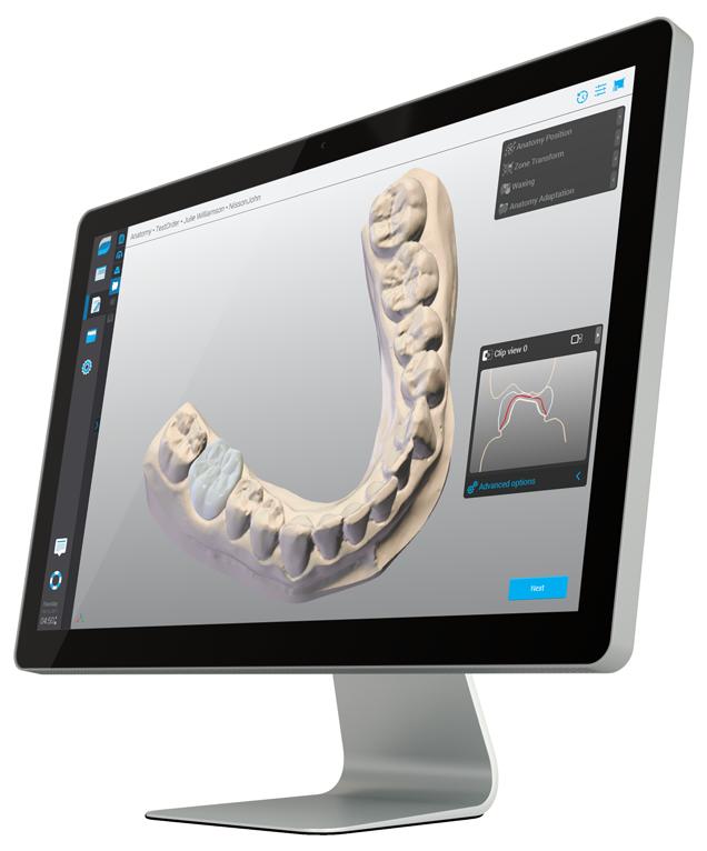 Specialists OPEN AND FLEXIBLE WORKFLOWS OPEN WORKFLOW With open.stl output available, you can send scan data to your favorite laboratory equipped with DWOS CAD or any open CAD design software.