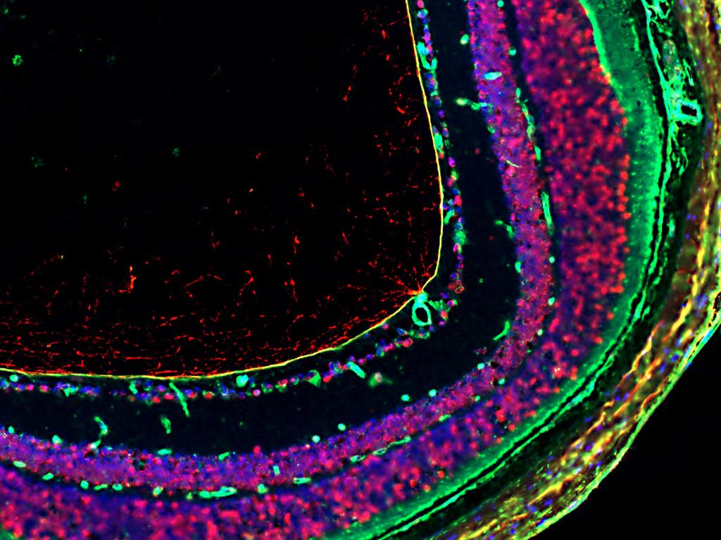 Histological Studies: Normal Mouse Eye Blue: Nuclear stainings Green: Collagen IV Red: Fibronectin Vitreous Body Vitreoretinal interface Inner