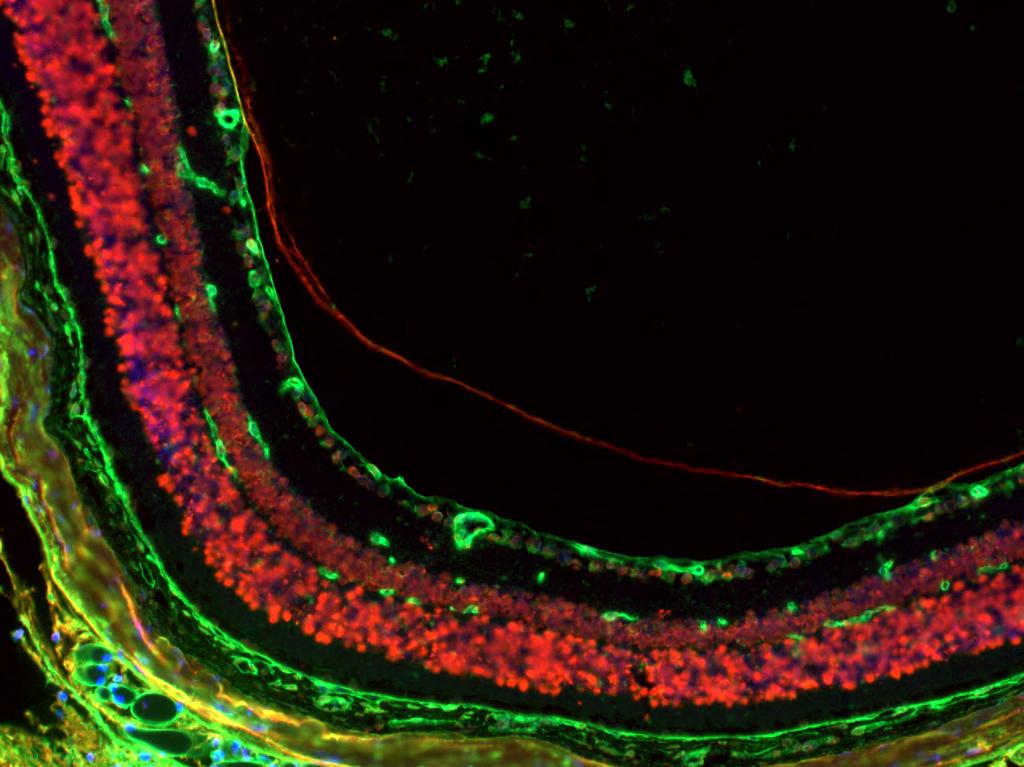 PVD After Ocriplasmin Injection in Mouse Eye Vitreous cortex Blue: Nuclear