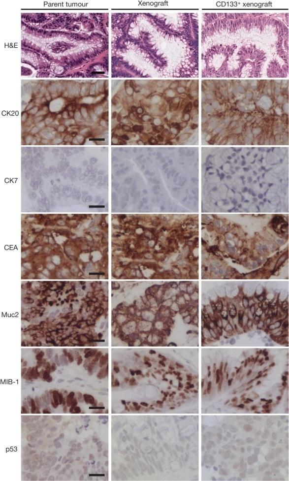 NOD/Scid/IL2R mice are excellent hosts for human CRC Human colon cancer cells NOD/SCID.