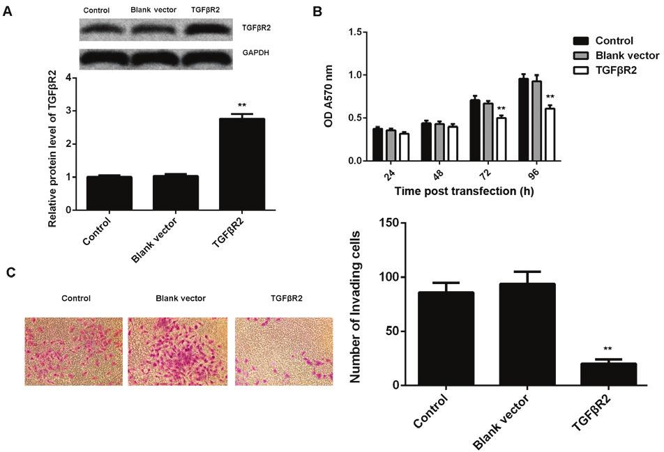 1424 MA et al: mir-19a PROMOTES NPC CELL VIABILITY Figure 4. TGFβR2 in nasopharyngeal carcinoma.