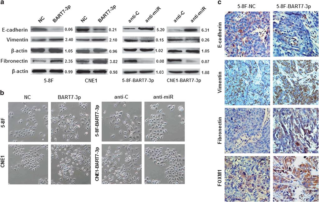 2158 stably expressing EBV-miR-BART7-3p (Figure 1c, Supplementary Figure S2b). To further validate the role of EBV-miR-BART7-3p in NPC metastasis, we established the mouse models of NPC metastasis.