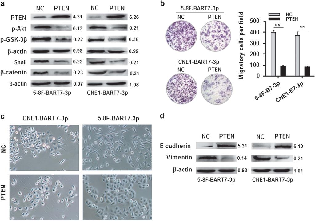 2162 Figure 6. Functional validation of PTEN effects on EBV-miR-BART7-3p-mediated EMT and metastatic phenotypes.
