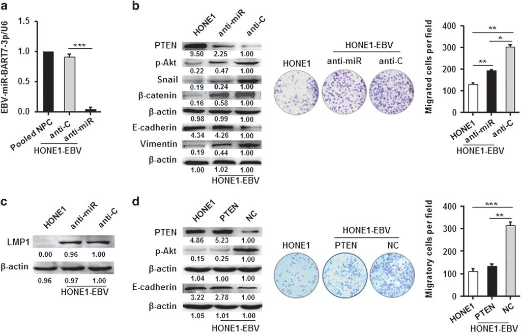2163 Figure 7. Silencing of endogenous EBV-miR-BART7-3p attenuates the EMT and cell migration in EBV-positive NPC cells.