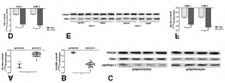 F. Yang, Q. Liu, C.-M. Hu Figure 1. MiR-155 was significantly increased in radio-resistant NPC and was negatively correlated to ubiqulin-1 expression.