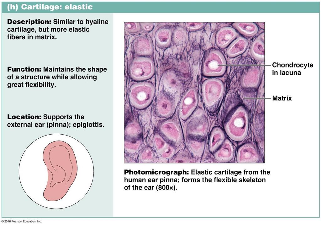 Elastic Cartilage Contains elastic fibers in the matrix.