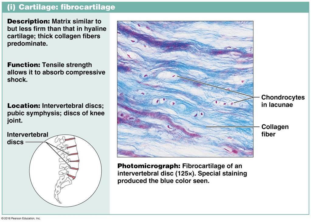 Fibrocartilage contains thick collagen fibers in the matrix.