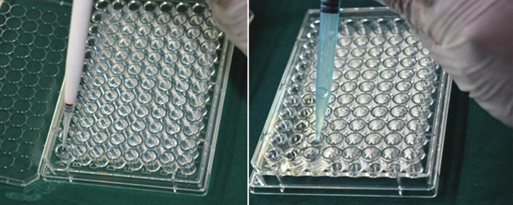 Figure 4: Flowchart depicting the cells and their corresponding numbers on the microtiter plate which the test group and control group were placed using a micropipette a b Figure 5: (a) Dispensing