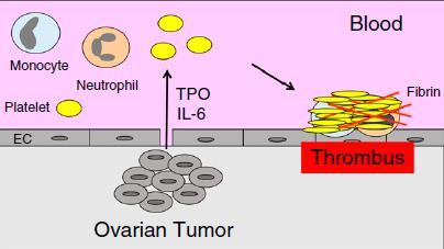 Cancer Type-specific Biomarkers TPO = thrombopoietin Thrombocytosis