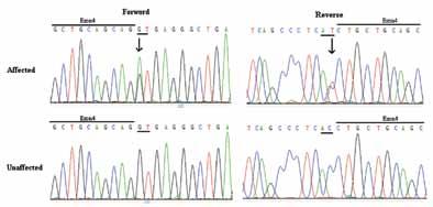 Figure 7. DNA sequence analysis of MEN1 in unaffected and affected individuals of family I. A heterozygous change T > A at IVS4+1 was noted in affected individuals. Figure 8.