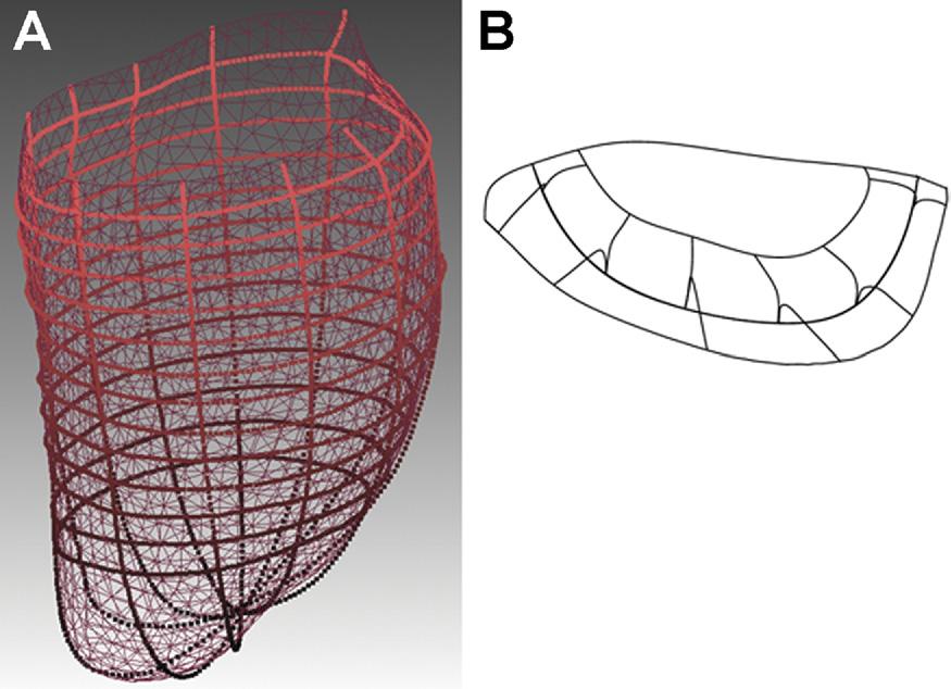 1548 WENK ET AL Ann Thorac Surg FE MODEL OF LV WITH MITRAL VALVE 2010;89:1546 54 Fig 2. Surface geometry developed in Rapidform.