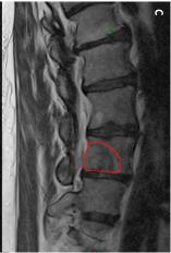 a report from the SPIne response