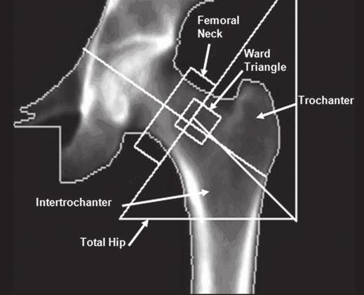 Image includes all of femoral head and at least 1 cm under region of lesser trochanter, which should not be seen owing to rotation.