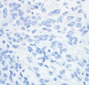 4A 5 6 Negative Control Tissue Stained with PD-L1 Primary Antibody Patient Specimen