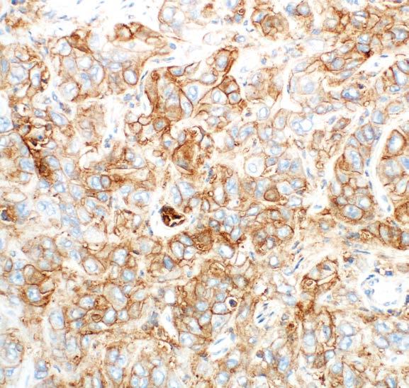 quality PD-L1 IHC 28-8 pharmdx Control Slide Stained with PD-L1 Primary