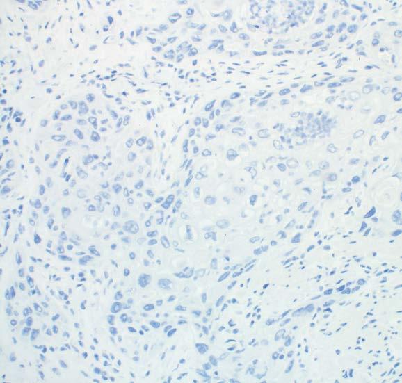 Reagent ACCEPTABLE Negative Control Tissue Stained with Negative Control