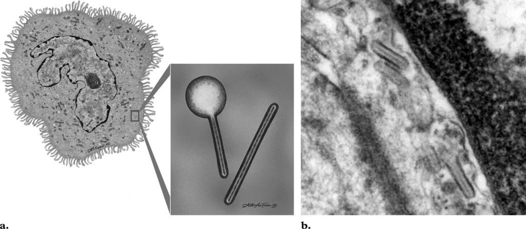 RG f Volume 24 Number 3 Abbott et al 825 Figure 2. Electron microscopic features of LCs.