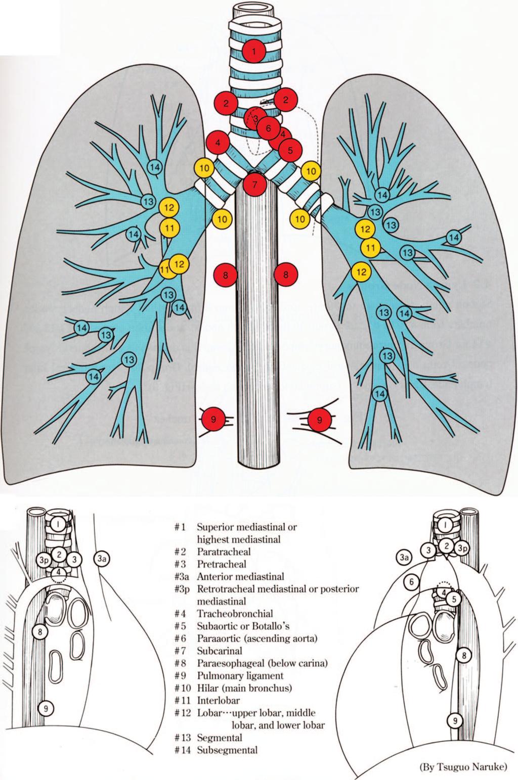 Journal of Thoracic Oncology Volume 4, Number 5, May 2009 FIGURE 1. The Naruke lymph node map for the staging of lung cancers as recommended by the Japan Lung Cancer Society.