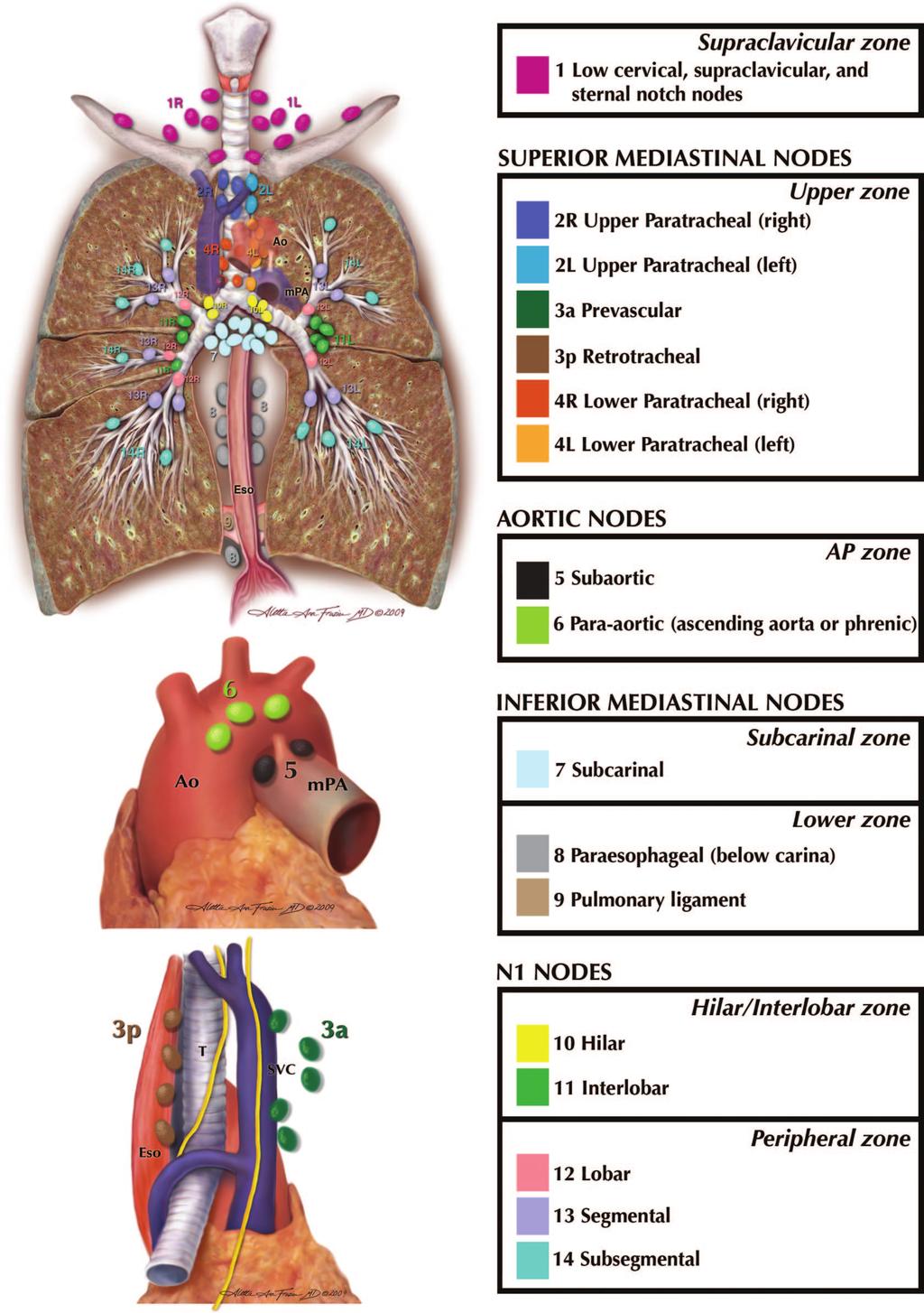 Rusch et al. Journal of Thoracic Oncology Volume 4, Number 5, May 2009 FIGURE 3.