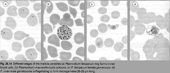 Page 9 of 11 A. smears show intraerythrocytic stages 1. Thick films for rapid diagnosis of parasitemia 2. Thin films (one blood cell thick) for speciating Plasmodia B.