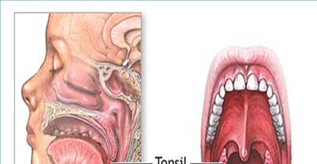 Tonsils -3 pairs: