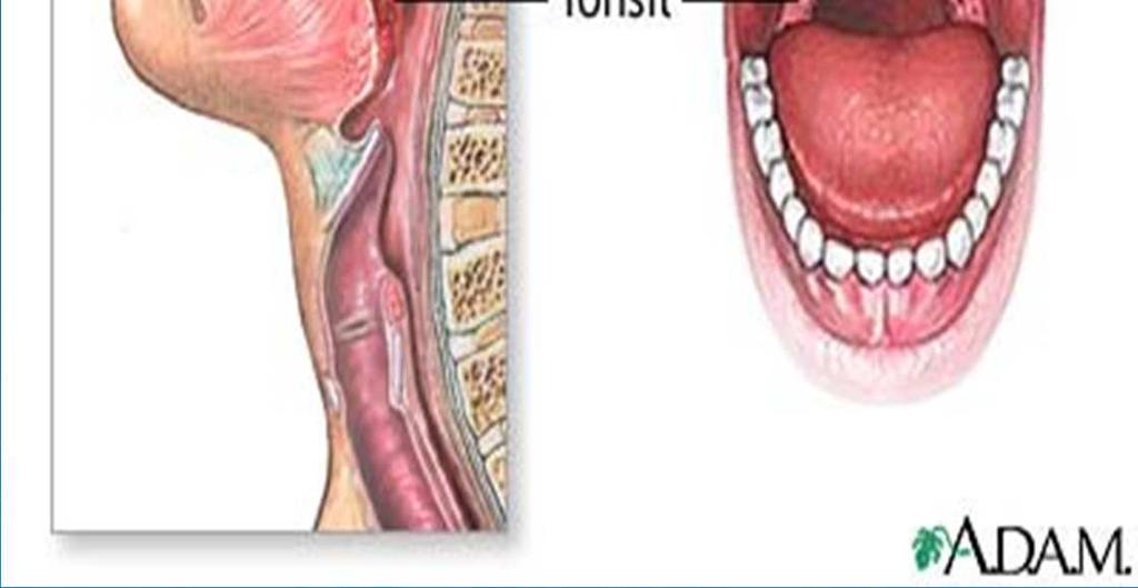 lingual -Lymph tissue that