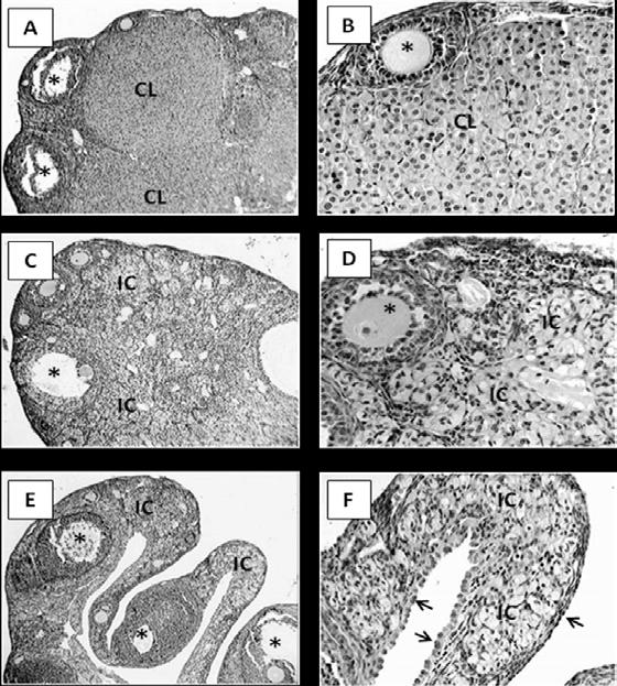 Figure 4.3 Histological structures of F1 ovaries (A) Representative ovary from mouse control group (CON-10); CL, corpus luteum; *, follicle; H&E, 100X. (B) High magnification of Figure 4.