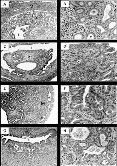 Figure 4.4 Histological structures of the uterus and cervix of F1 mice (A) Representative uterus from mouse of control group (CON-10); L, lumen; E, endometrium; M, myometrium; H&E, 100X.
