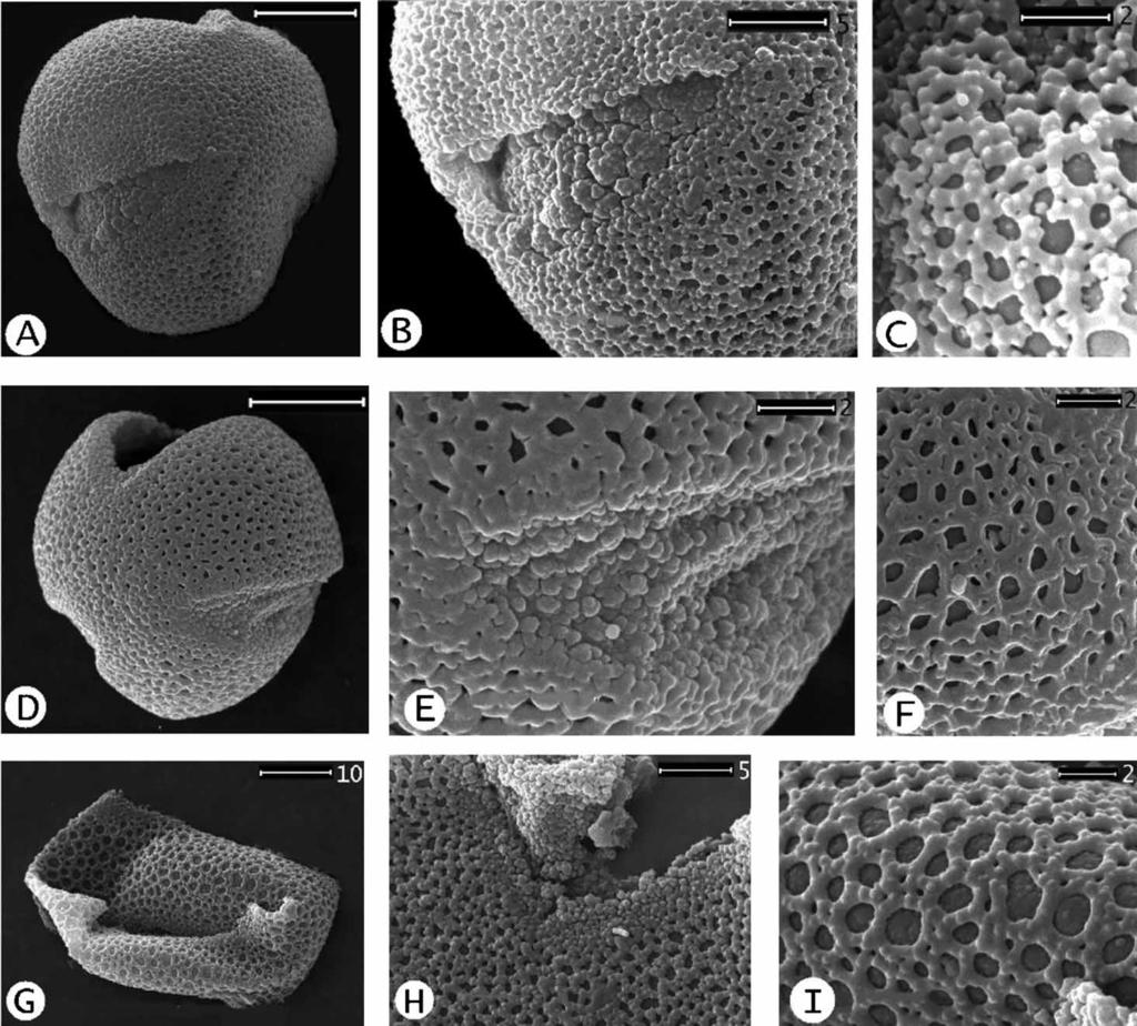Parrotia persica in the Mazovian of Poland 229 Fig. 2. SEM micrographs of modern pollen. A C.