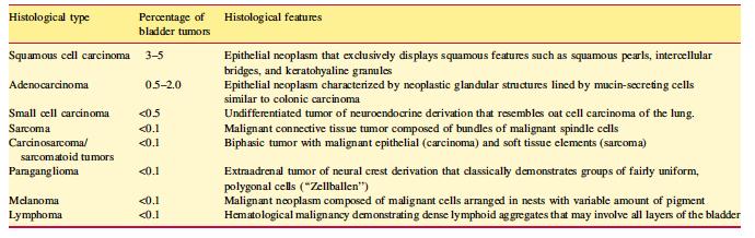 Non-urothelial bladder cancer Mixed with urothelial Any small cell component: Localized disease Any small cell component: Metastatic disease Pure Squamous Pure